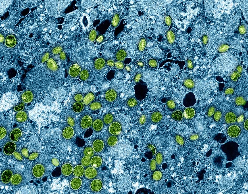 Colorized transmission electron micrograph of mpox virus particles