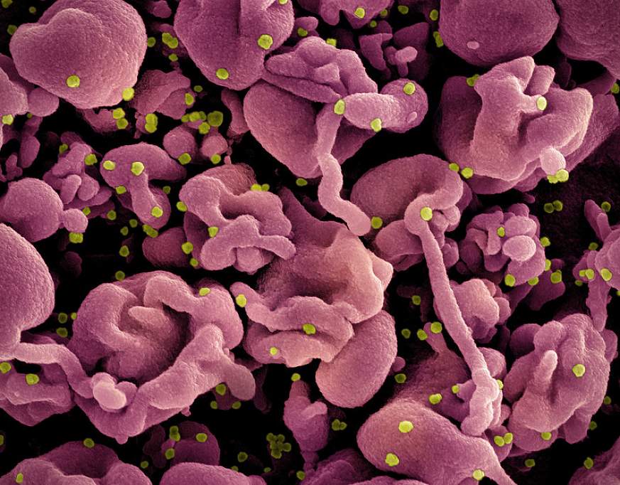 Novel coronavirus SARS CoV-2 (Omicron).