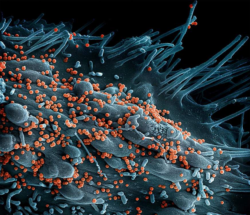 Scanning electron micrograph of Lassa virus budding off a cell. 