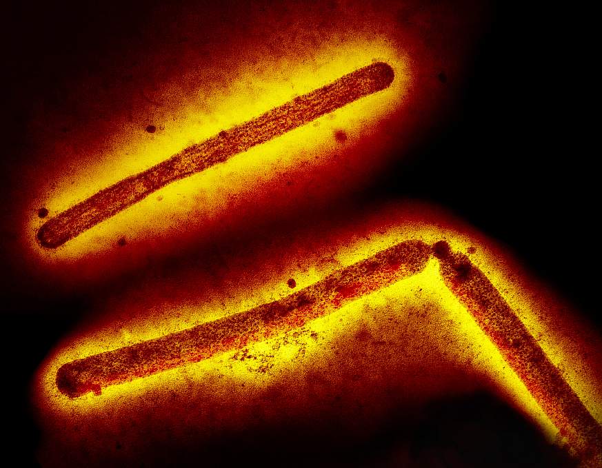 Virus de la grippe A (H5N1/grippe aviaire)