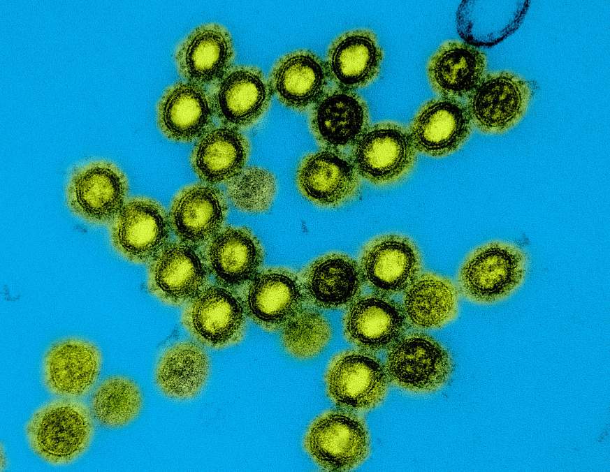 Colorized transmission electron micrograph of influenza A/H1N1 virus particles. 
