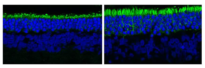 Side-by-side images show untreated, shorter rod photoreceptors next to longer rods treated with reserpine.