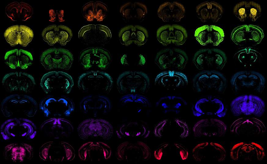 Multiple images of the mouse brain on a black background with various cells highlighted to portray the precision access of new genetic tools developed. 
