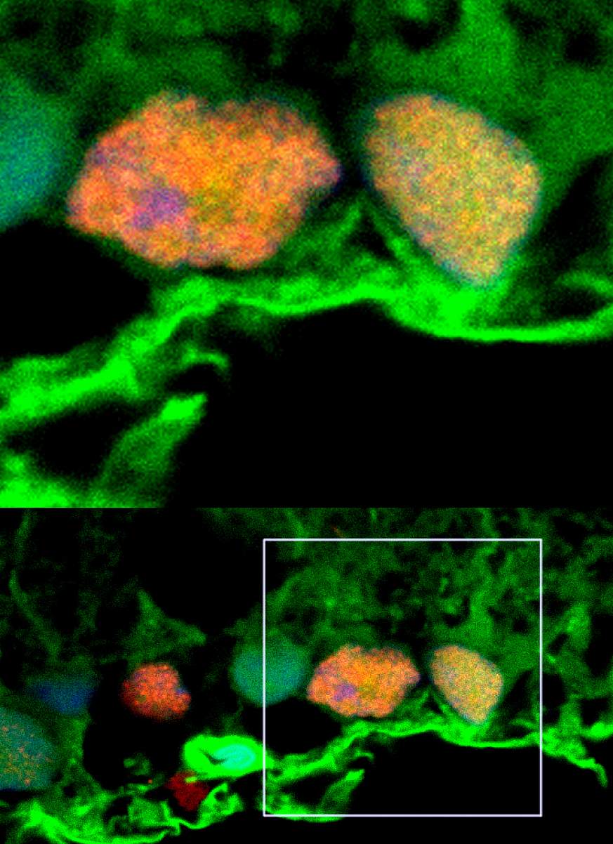 Image of exosomes and retinal cells