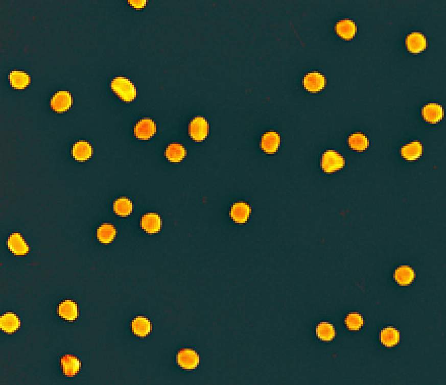 Microscopic image of gold-colored nanoparticles.