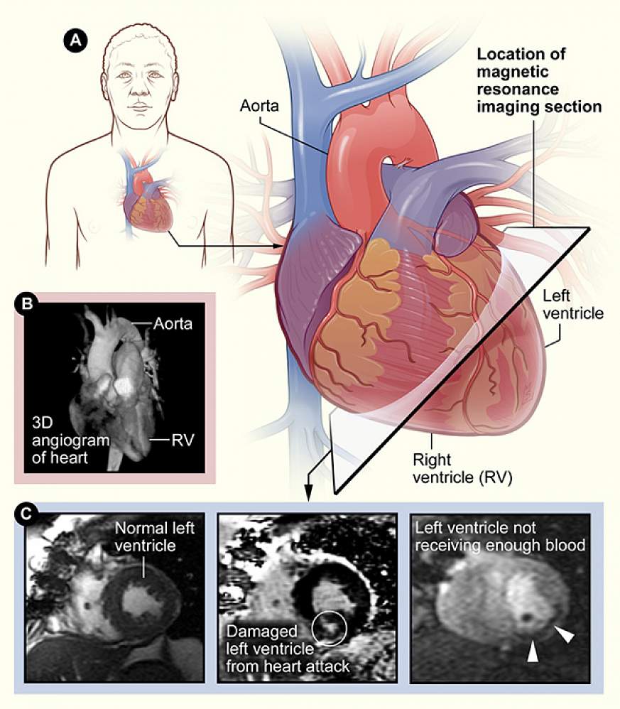 3 panel image showing different methods of viewing the heart.