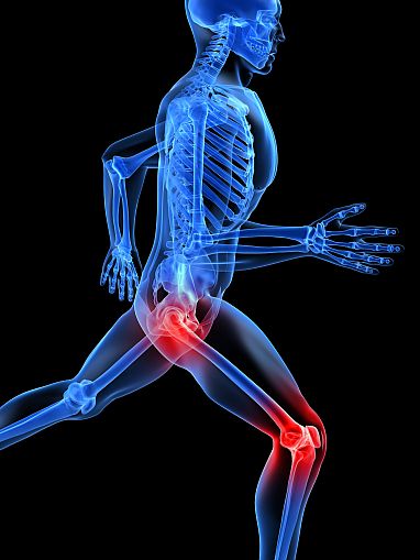 Illustration of human skeleton with hip and knee joints glowing red.