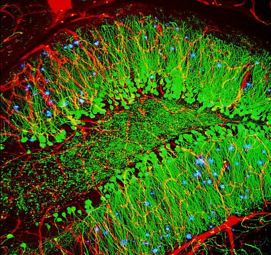 Mouse brain with hallmarks of Alzheimer’s disease