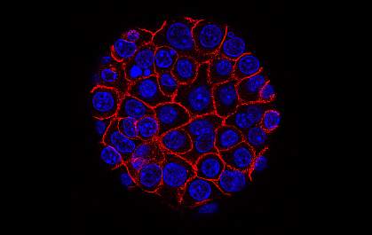 Pancreatic Cancer Cells
