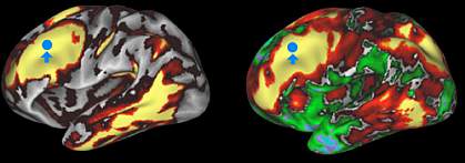 structural and functional connectivity in human brain Image 