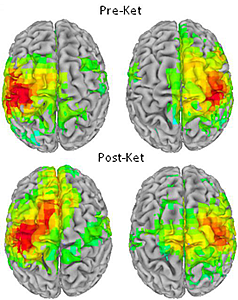Scanned brain images with response areas highlighted