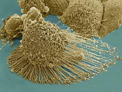 Microscopic image of a cell.