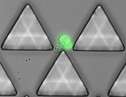 Image of magnified circulating tumor cell cluster