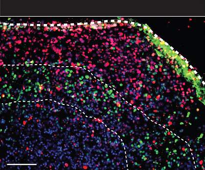 Cross section of spheroids.