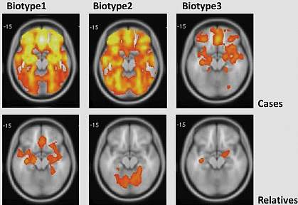 MRI scans