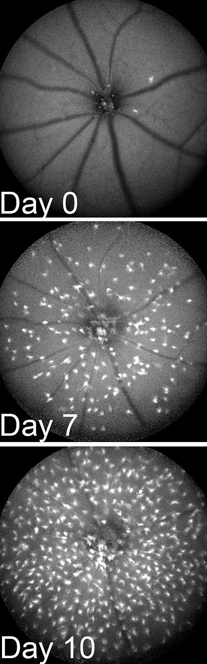 Image of retinal scans for microglia in mice