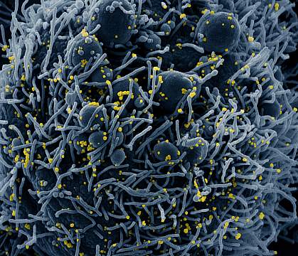 Novel Coronavirus SARS-CoV-2