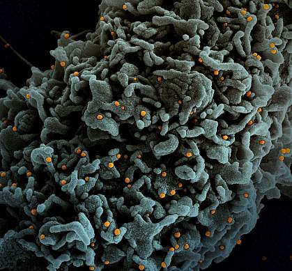 Novel Coronavirus SARS-CoV-2