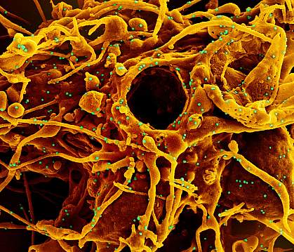 Novel Coronavirus SARS-CoV-2