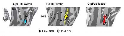 illustrations of three regions from within the ventral temporal cortex.