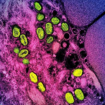 Green monkeypox particles in an infected cell visualized in pink and purple