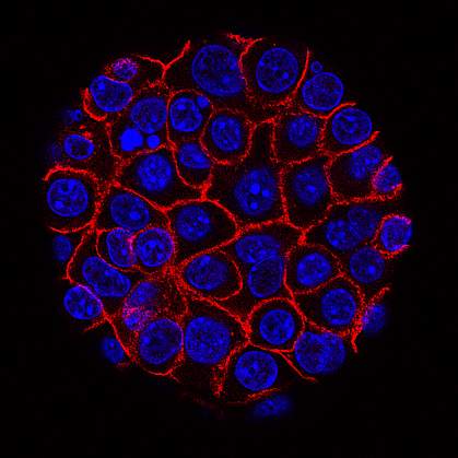 Pancreatic cancer cells