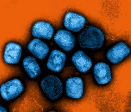 Colorized transmission electron micrograph of mpox virus particles (blue) cultivated and purified from cell culture. 