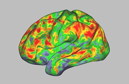 Image showing brain activity during a dose of psilocybin.
