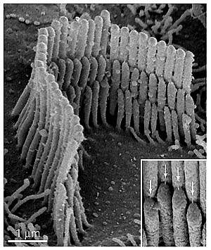 Microscopic structures called stereocilia sit atop a hair cell