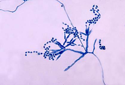 One type of fungus (a Penicillium) under the microscope