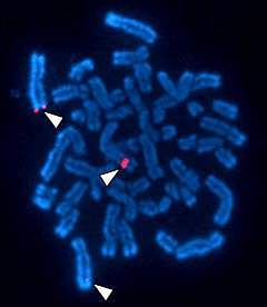 Picture of the SUM01 Gene in Human Chromosomes
