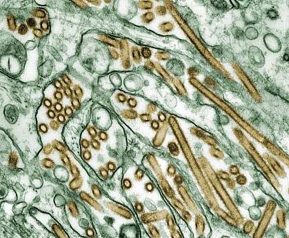 Picture of Avian influenza viruses (gold) grown in culture cells (green)