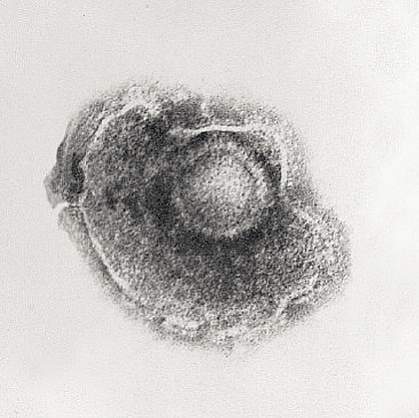 Picture of the varicella-zoster virus close up