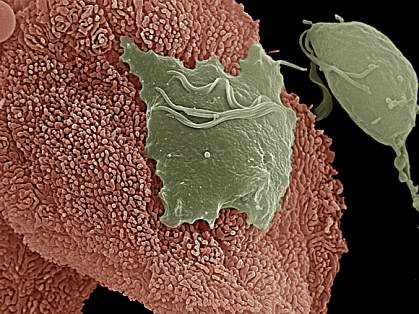 ray parasite attached to vaginal cell on left is flat, while a parasite that's not attached, on right, is pear-shaped