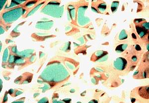 A highly magnified photograph of porous bone matrix