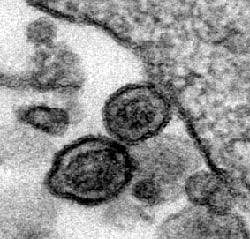 Black and white electron micrograph showing two circular viruses in the center and, to the right, the edge of the larger cell they have just left