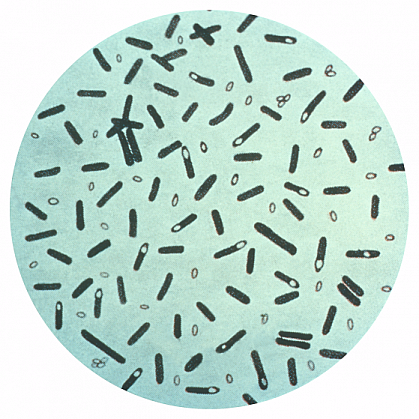 Clostridium botulinum bacteria up close.