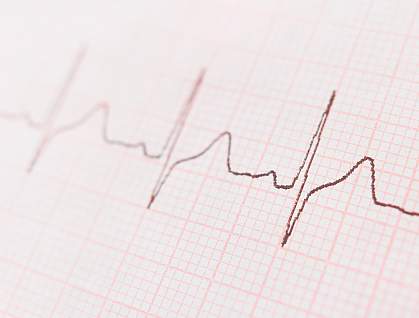 ECG graph showing the heart's rhythm