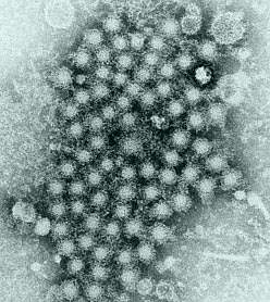 Image with a large cluster of circular viruses