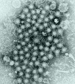 Image with a large cluster of circular viruses