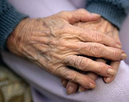 Photo of a pair of arthritic hands