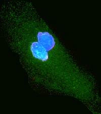 Photo of two blue blobs next to each other in an elliptical green cell