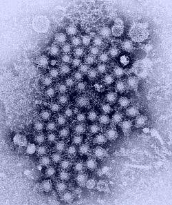 Hepatitis viruses appear as diffuse dark circles clustered together on a light background