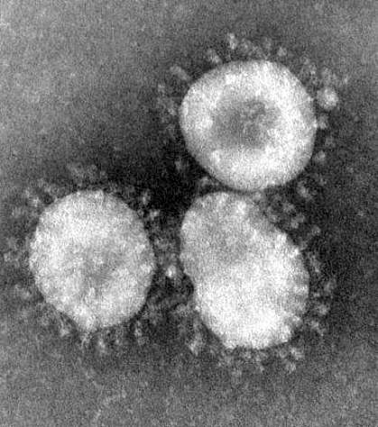 Black and white image of 4 circular viruses with coronas, or halos around them