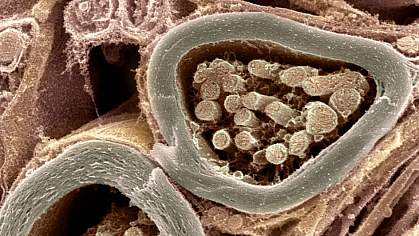 Cross-section of 2 nerve fibers with thick sheaths