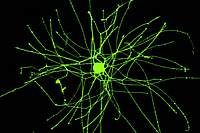 Round cell body with long tendrils  reaching in all directions