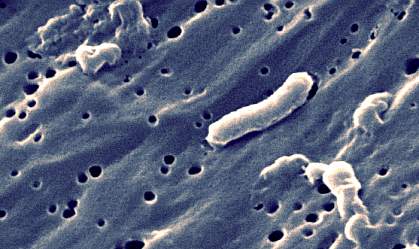 Photograph of long, tubular bacterium
