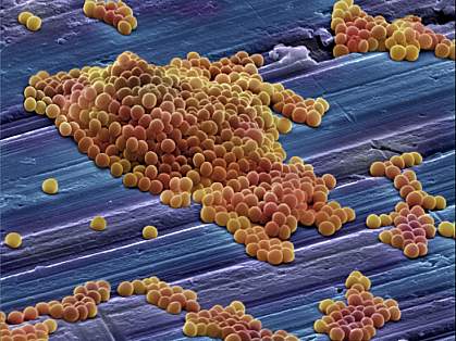 Scanning electron micrograph shows clusters of spherical staph bacteria