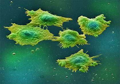Scanning electron micrograph of 5 cells spread on a surface