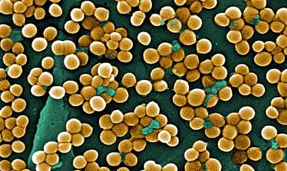 Clusters of round, golden bacteria